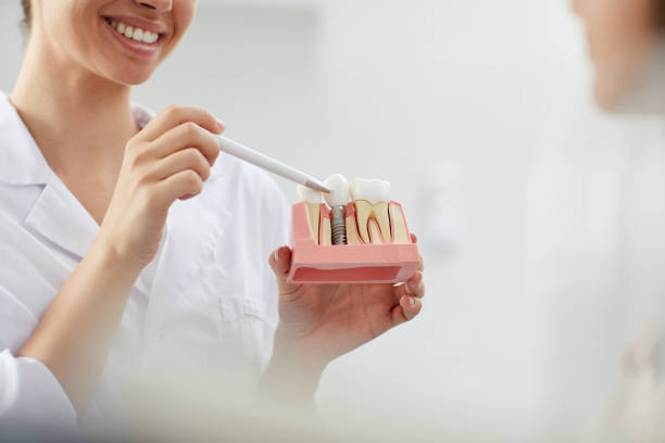 4 Signs It’s Time To Discuss Dental Implants With Your Dentist